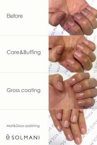 メンズネイル 巻き爪にお悩みなら恵比寿 代官山のネイルサロン Solmani